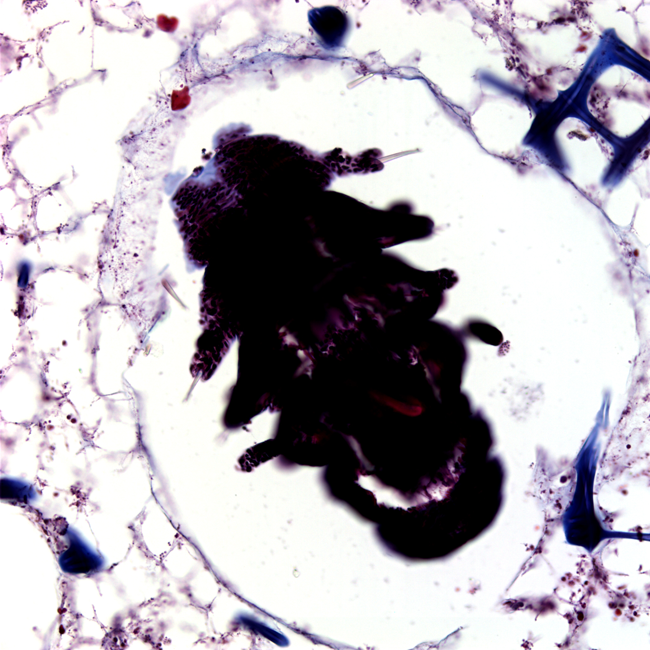 Polychaete in Callyspongia (Masson a microscopic image of polychaete in callyspongia. taken with a light microscope