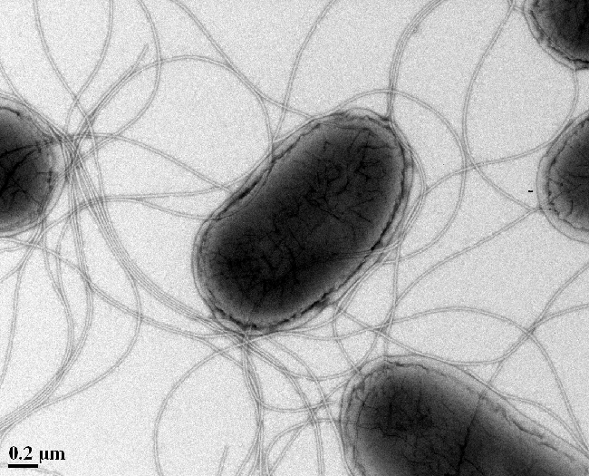 Bacteria with Flagella (negative stain) a negative stain of bacteria cells with flagella, taken with a transmission electron microscope