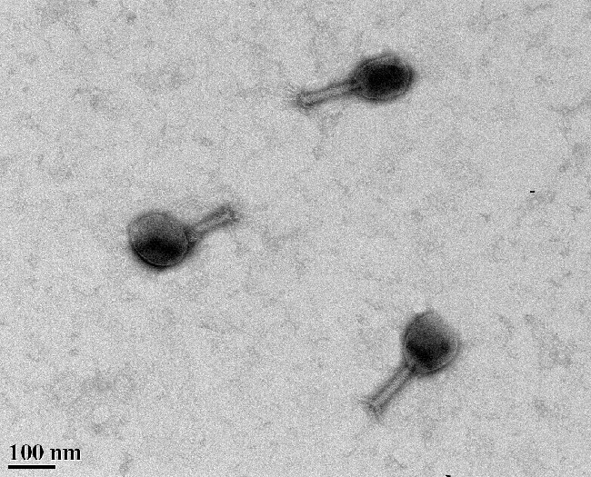 Bacteriophage Three bacterophages, taken with a transmission electron microscope