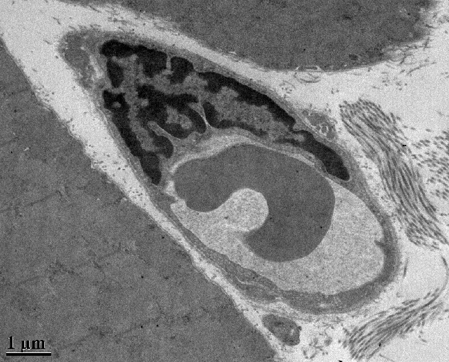 Capillary within Muscle, Showing Endothelia Cell and Red Blood Cells a muscle capillary with endolithia and red blood cells, taken with a transmission electron microscope