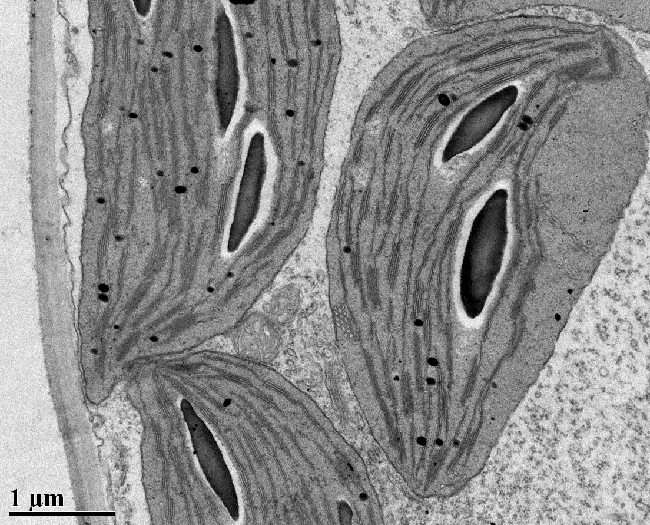 Plastids within a Plant Cell a microscopic image of the plastids within a plant cell, taken with a transmission electron microscope